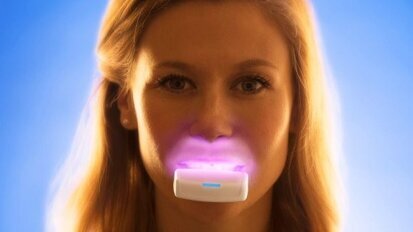 Intra-orale lichttherapie kan duur orthobehandeling verkorten