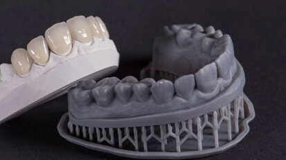 Predictability of the CAD/CAM workflow in today’s aesthetic cases