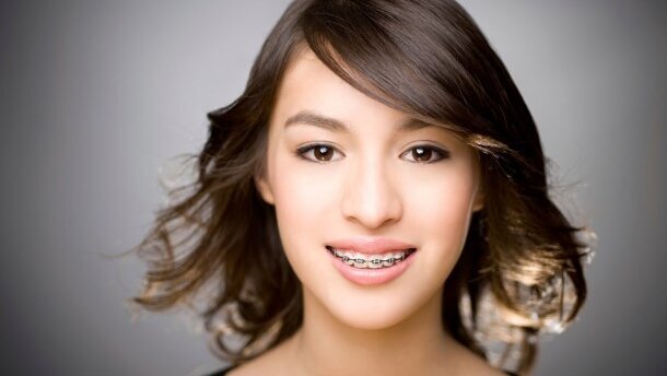 Kłopotliwy aparat ortodontyczny