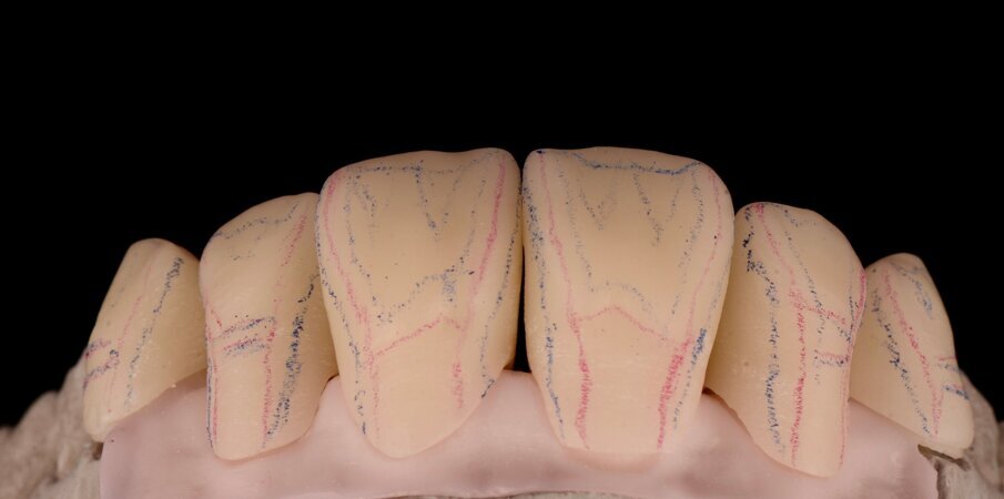 Fig. 22: Engineering of the micro- and microtexture of the surface.