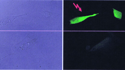 Photodamage of dental pulpa stem cells during 700 fs laser exposure