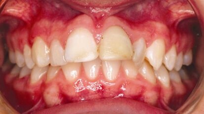 Rimuginando sulla verità