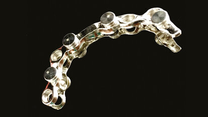 Overdenture su 4 impianti con utilizzo di attacchi OT Equator con barra passivata da elastic seeger