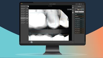 Pearl introduces AI solution for dental pathology detection Pearl introduces AI solution for dental pathology detection