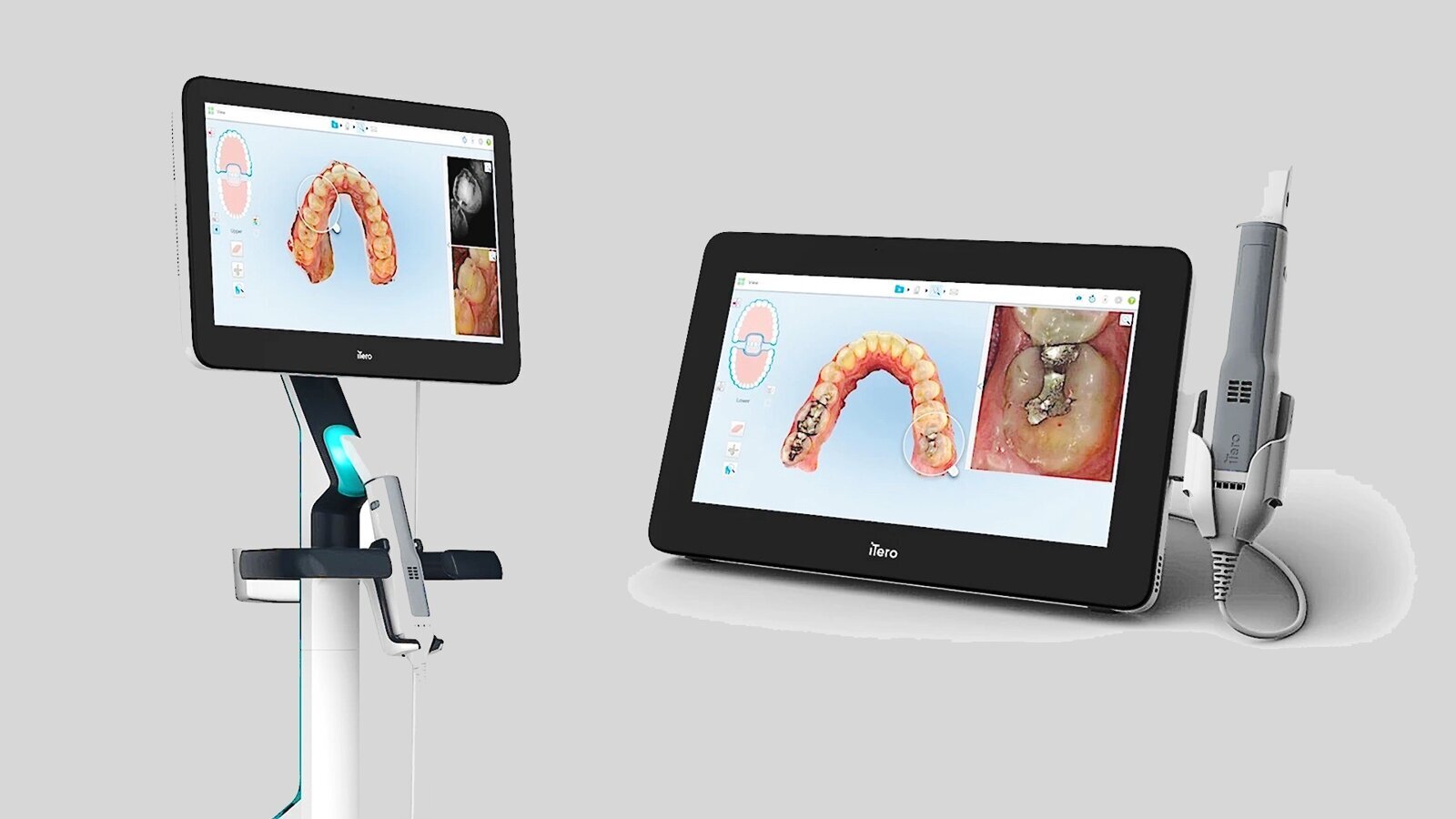 Tecnologías y características de los escáneres intraorales (1)  