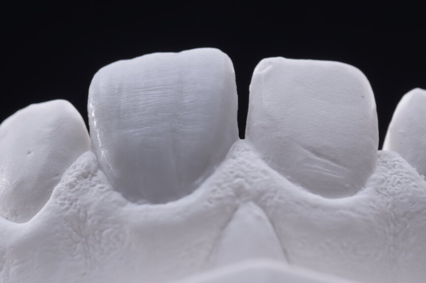 Fig. 28: Final wax-up and texture.