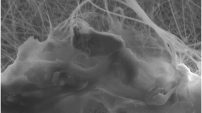 Microplastics and orthodontic aligners: Concerns arising from the modernisation of practice through plastics