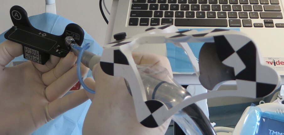 Figg. 10a-10g - Il Drill Tag peculiarità del Navident (a). Questo dispositivo consente di guidare qualsiasi strumento chirurgico. Non potendo essere note a priori le caratteristiche geometriche tridimensionali dello strumento lavorante è necessaria una calibrazione preliminare al gesto chirurgico (b-d). Esempio di navigazione di un Magnetic Mallet (e). Supporto software che consente l’identificazione delle diverse possibili tipologie di strumenti chirurgici guidati (f, g).