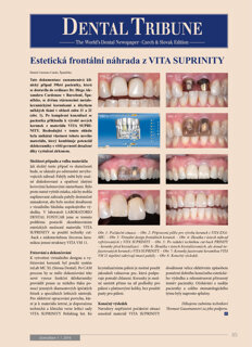 DT Czech and Slovak Republic No. 1, 2016