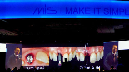 Professor Joseph Kan offered a fun but profound lecture on successes and failures in implant dentistry.