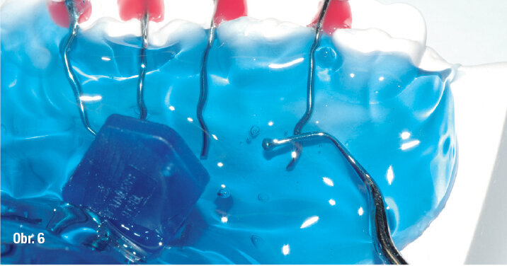 Postup práce s Orthocryl LC