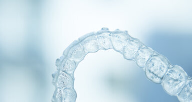 Orthodontists concerned about the emergence of DIY clear aligners