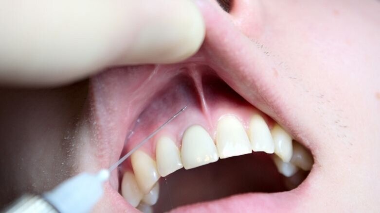 Routinebehandeling fataal voor driejarige