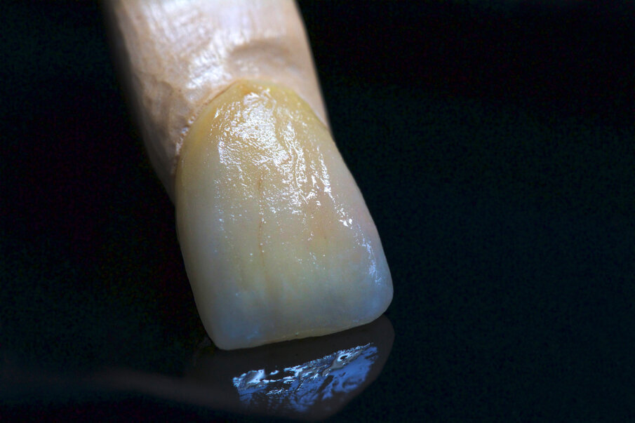 Fig. 6: The VITA INTERNO stains allow for a multifaceted and age-appropriate reproduction of the natural teeth.