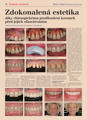 DT Czech and Slovak Republic