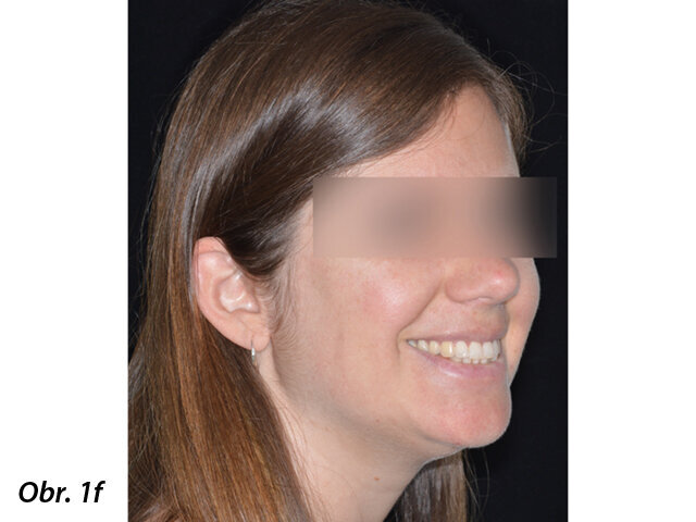 Pacientka 1 – Počáteční fotografie.