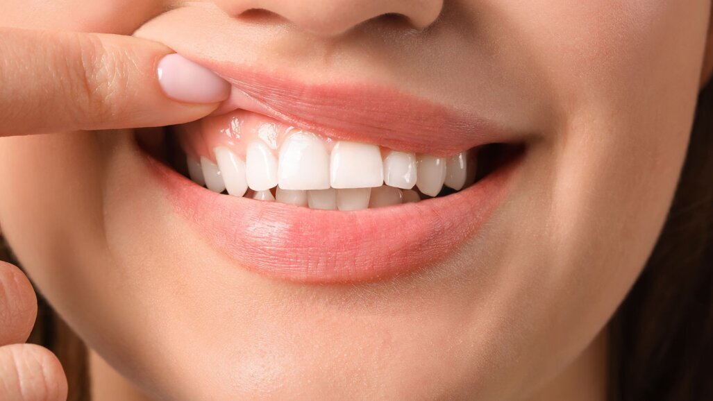 12 mei Dag van het Tandvlees. Doet je praktijk ook mee?