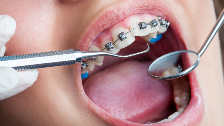 DGKFO befürwortet Forderung nach mehr Forschung in der KFO