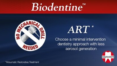 Biodentine and ART: Minimising droplets and aerosol generation Biodentine and ART: Minimising droplets and aerosol generation