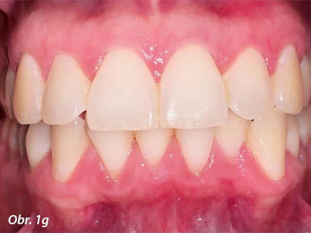 Pacientka 1 – Počáteční fotografie.