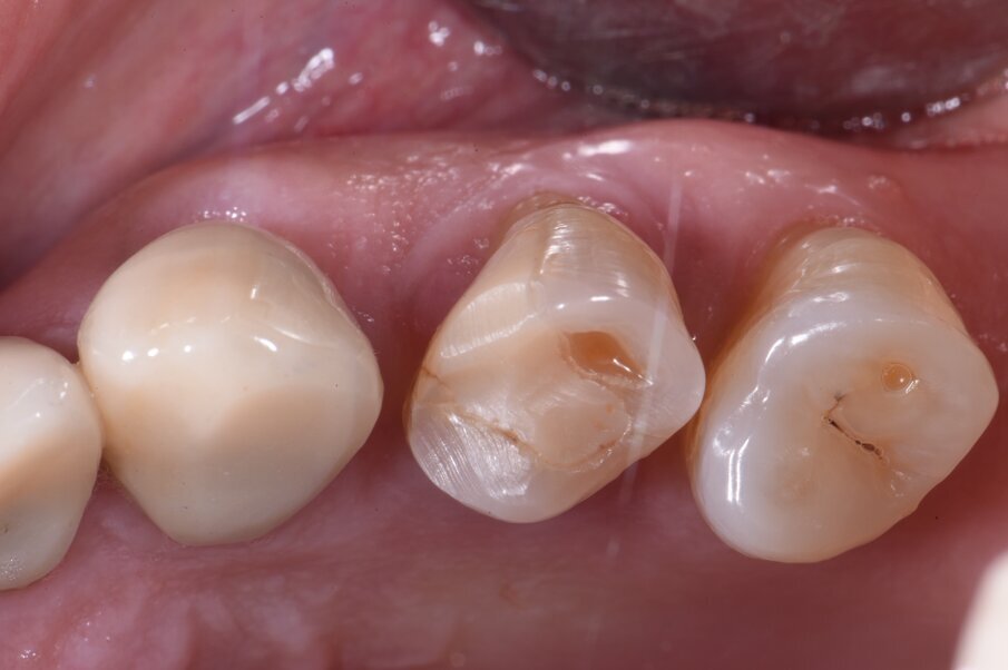 Fig. 1a - Caso clinico.