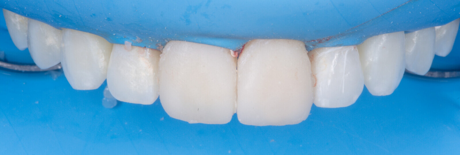 Fig. 21 : Résultat sous digue après les premières finitions.