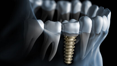 10. Internationaler Jahreskongress der DGOI in München