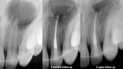 One system, different motions for daily challenges