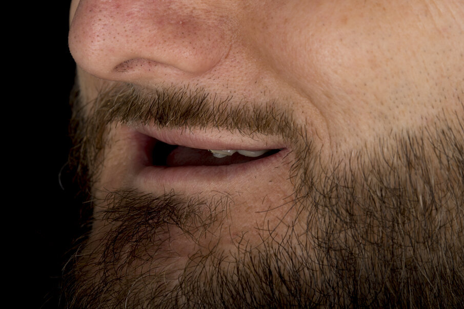 Figg. 1-3 - Fotografie preoperatorie. 