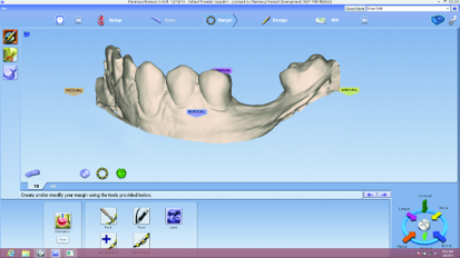 Restorative-driven implant therapy