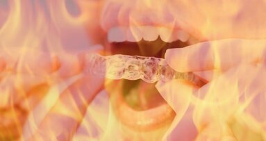 ¡Cuidado con los tratamientos dentales que se publicitan en redes!