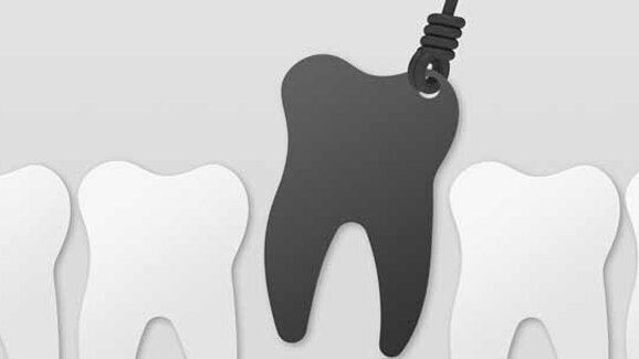 Warum wird in Deutschland so wenig implantiert?