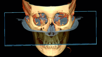 The role of 3-D imaging systems in present orthodontics