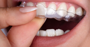 Launch of Aligner Dental Academy announced