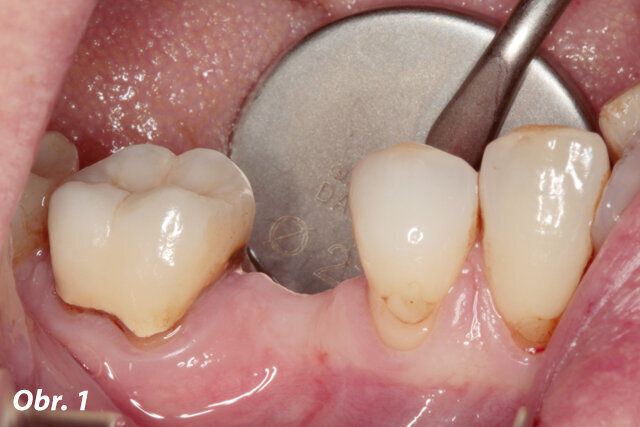 Obr. 1: Výchozí situace – pacientka, 53 let