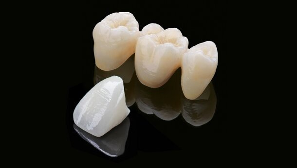 Zirlux FC2 : un système innovant pour des restaurations toujours plus fiables et esthétiques