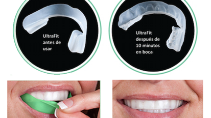 Opalescence Go, la evolución del blanqueamiento