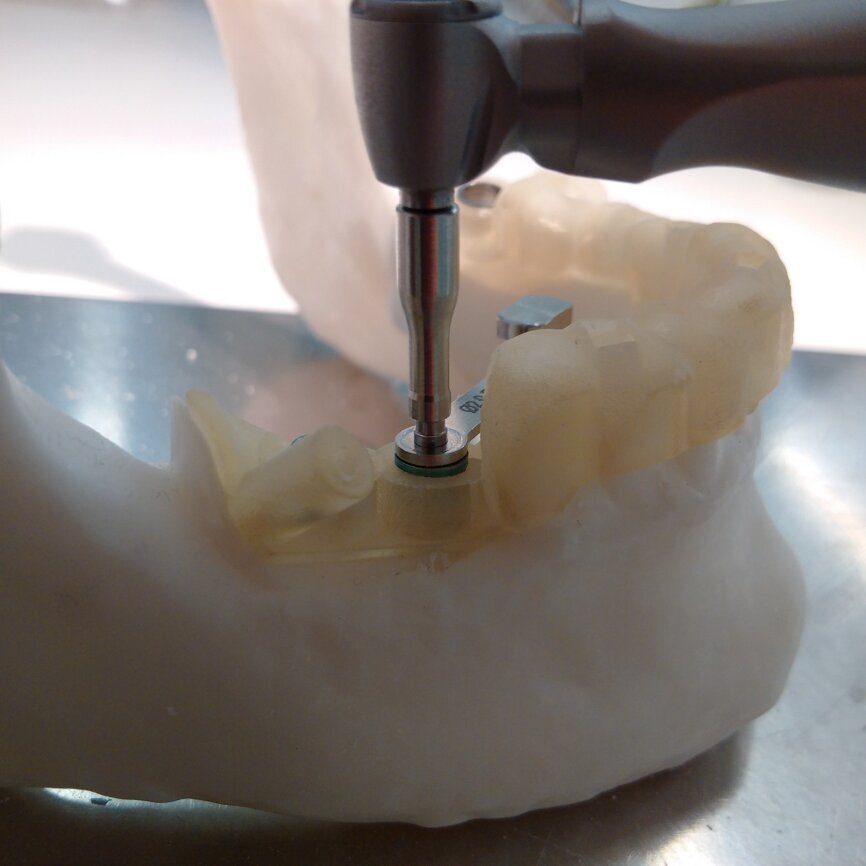 Ryc. 5_Wiertło na przedłużce prowadzone przez tuleję redukcyjną. Przedłużka umożliwia prawidłowe prowadzenie wiertła bez dotykania kątnicą o szablon na sąsiednim zębie. Klinicznie użycie przedłużki, zwłaszcza w okolicy po zębach trzonowych, może być jednak niemożliwe ze względu na ograniczone rozwarcie szczęk.