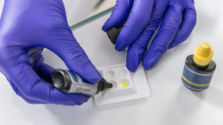 Study compares dentine penetration ability of root canal sealers and obturation methods