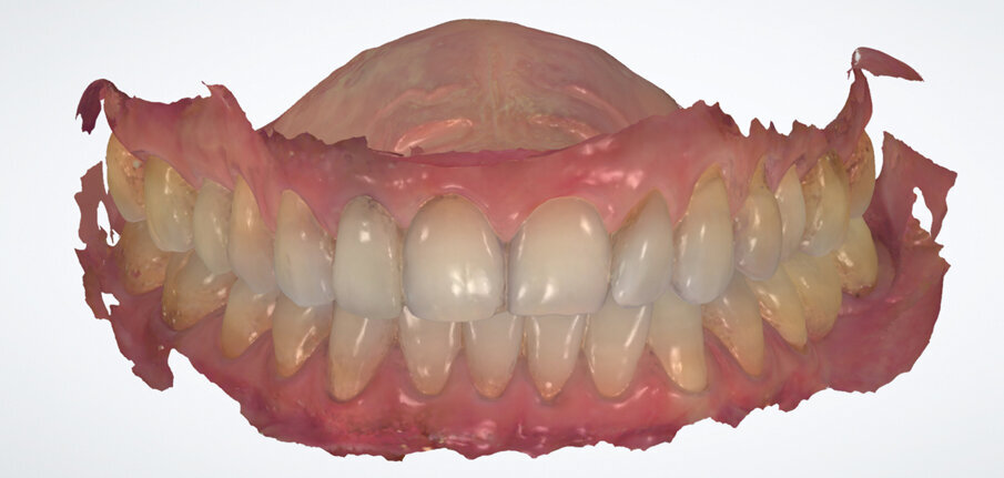 Fig. 3. Surface scan of the preoperative situation