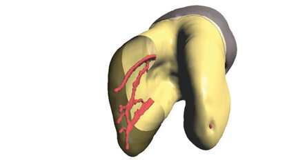 Microendodontics? Microendodontics?