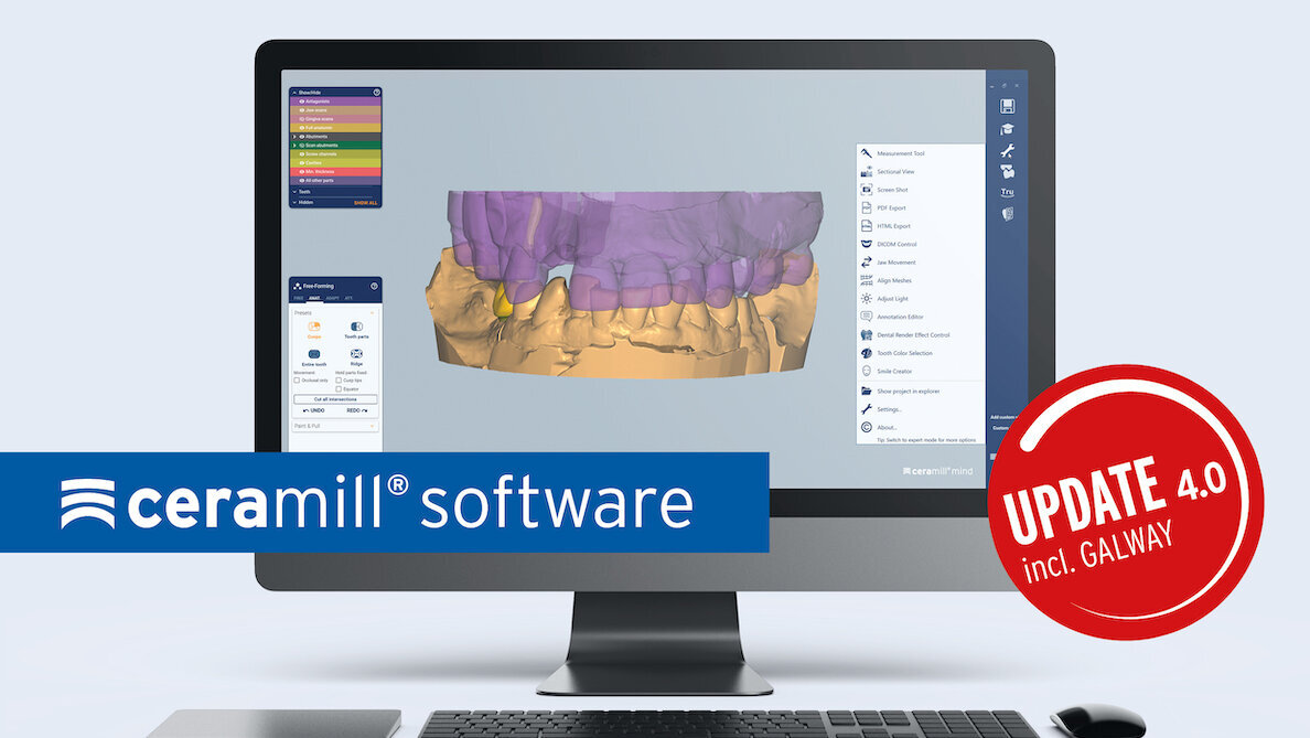 Amann Girrbach optimiza todo el software de Ceramill
