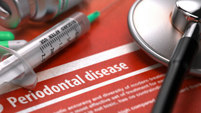 Correlazione tra aterosclerosi coronarica e disturbi parodontali