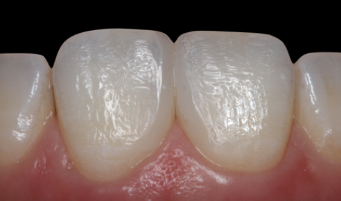 Fig. 14: Control image after one month