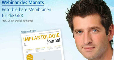 Webinar: Resorbierbare Membranen für die GBR