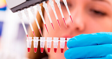 Niente più otturazioni grazie alle staminali: commento a una notizia apparsa su La Stampa