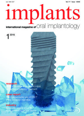 implants international No. 1, 2016 implants international No. 1, 2016