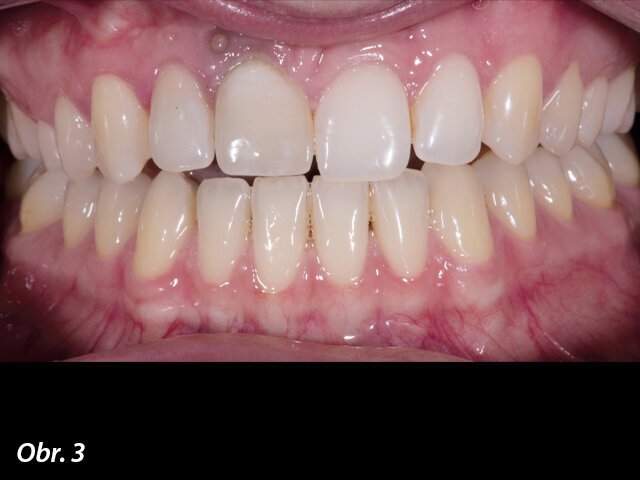 Výchozí stav u pacientky.