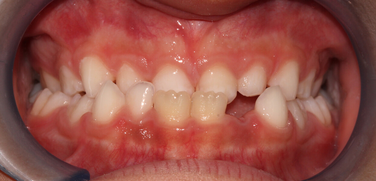 Fig. 6b: Frontal view.