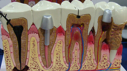 Meeting Review: 2016 Thomas P. Hinman Dental Meeting